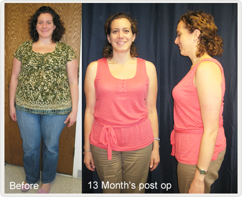 Weight Loss in Progress: Sonya's Update After Gastric Sleeve
